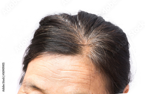 Closeup wrinkles on forehead and grey hair old woman, health care and medical concept