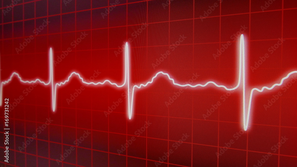 Medical issue Medical issue