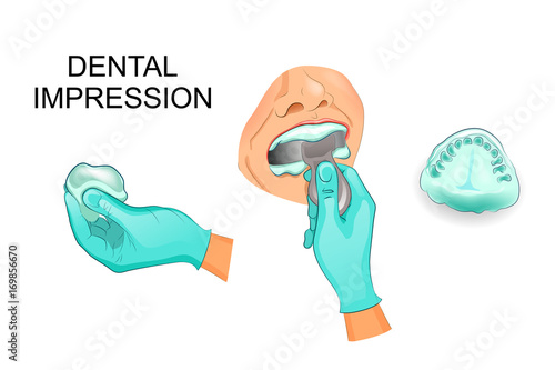 dental impression, dentistry