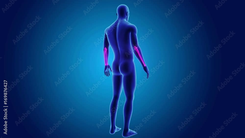 Ulna and radius with body Ulna and radius with body
