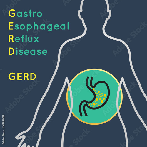 Gastroesophageal Reflux Disease (GERD) vector collection