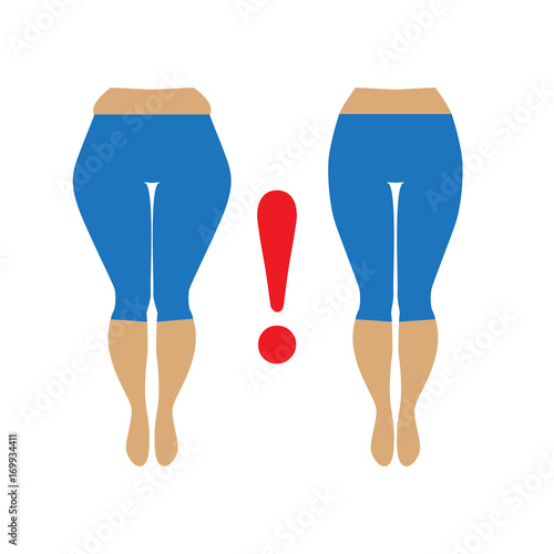 Fat and slim womans hip. Illustration of a woman with cellulite and smooth skin.  Weight loss concept