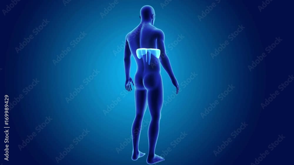 Diaphragm with Body Diaphragm with Body