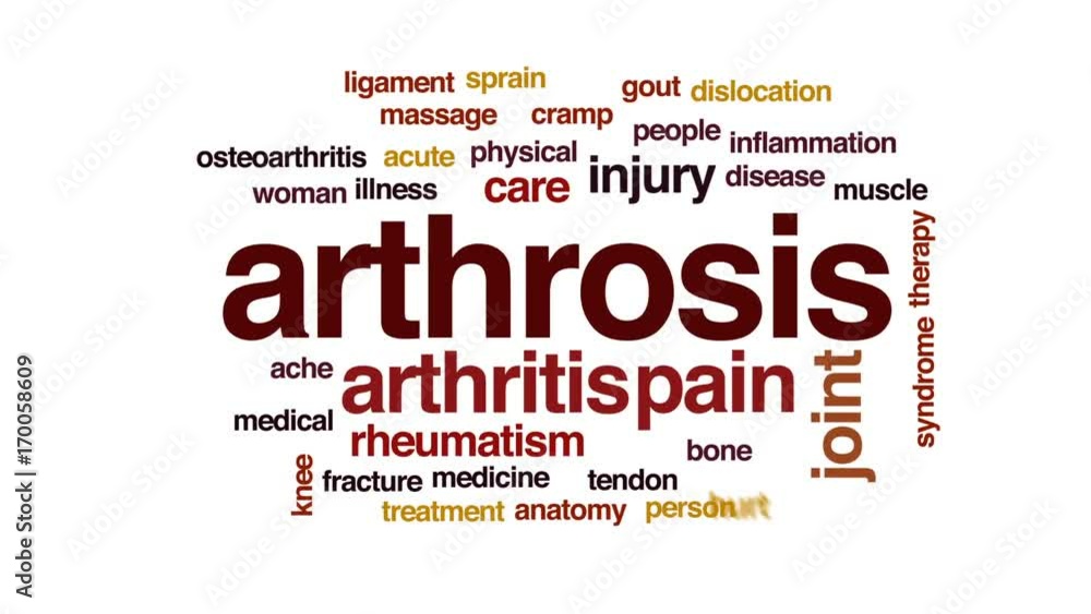 Arthrosis animated word cloud, text design animation. Arthrosis animated word cloud, text design animation.