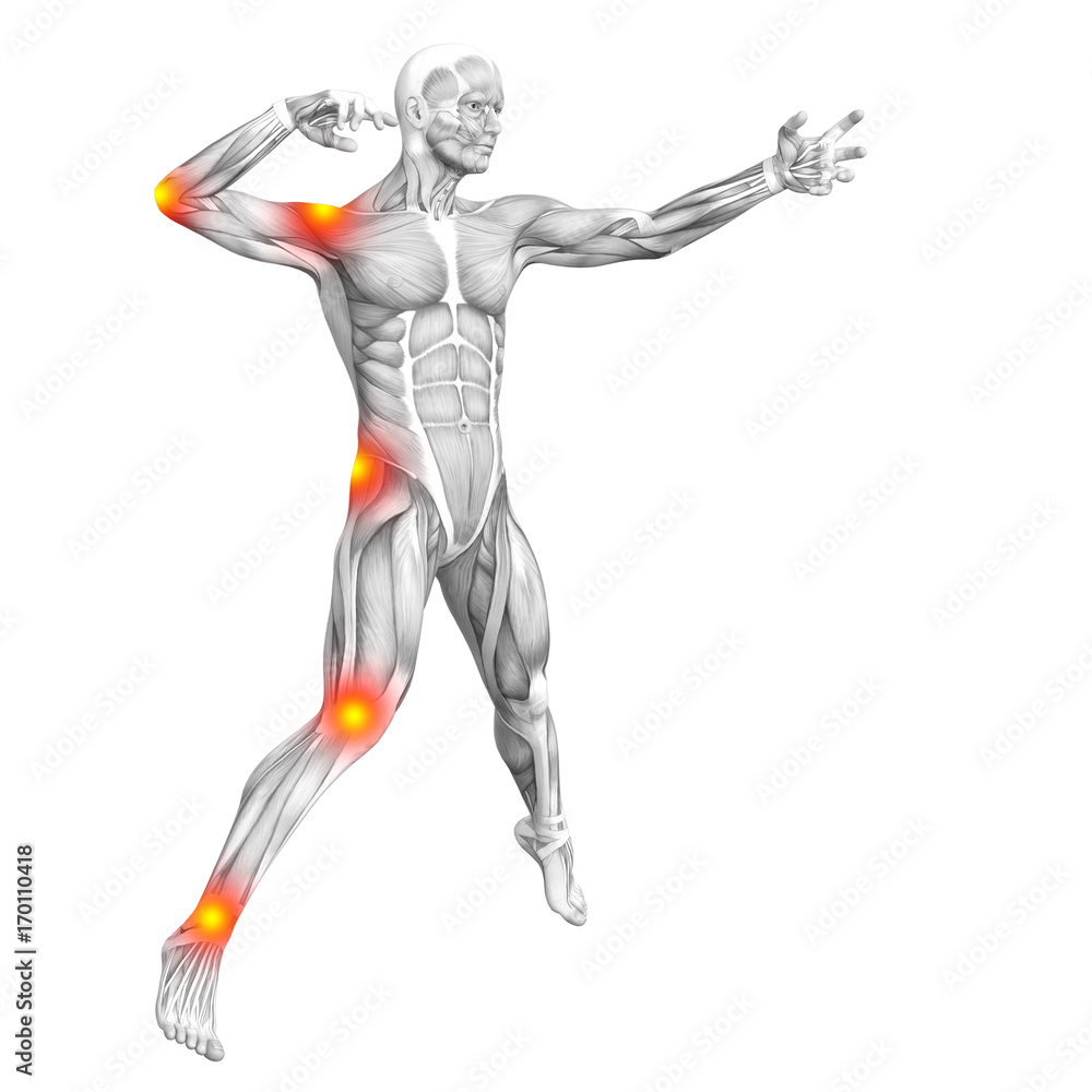 Conceptual human muscle anatomy with red and yellow hot spot inflammation or articular joint pain for health care therapy or sport concepts. 3D illustration man arthritis or bone osteoporosis disease Conceptual human muscle anatomy with red and yellow hot spot inflammation or articular joint pain for health care therapy or sport concepts. 3D illustration man arthritis or bone osteoporosis disease