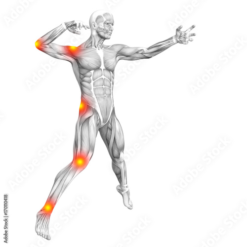 Conceptual human muscle anatomy with red and yellow hot spot inflammation or articular joint pain for health care therapy or sport concepts. 3D illustration man arthritis or bone osteoporosis disease