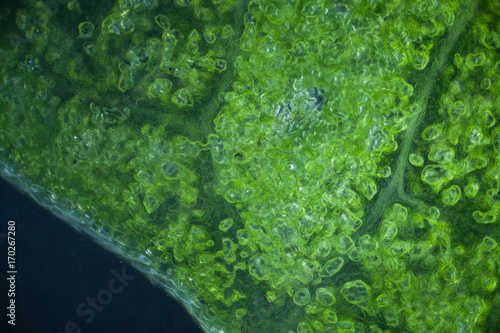 Lettuce cells under microscope, magnification x 100 dark field technique photo