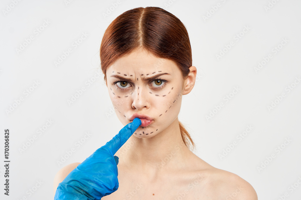 plastic surgery, a beautiful woman with an outline for an operation on the face, portrait