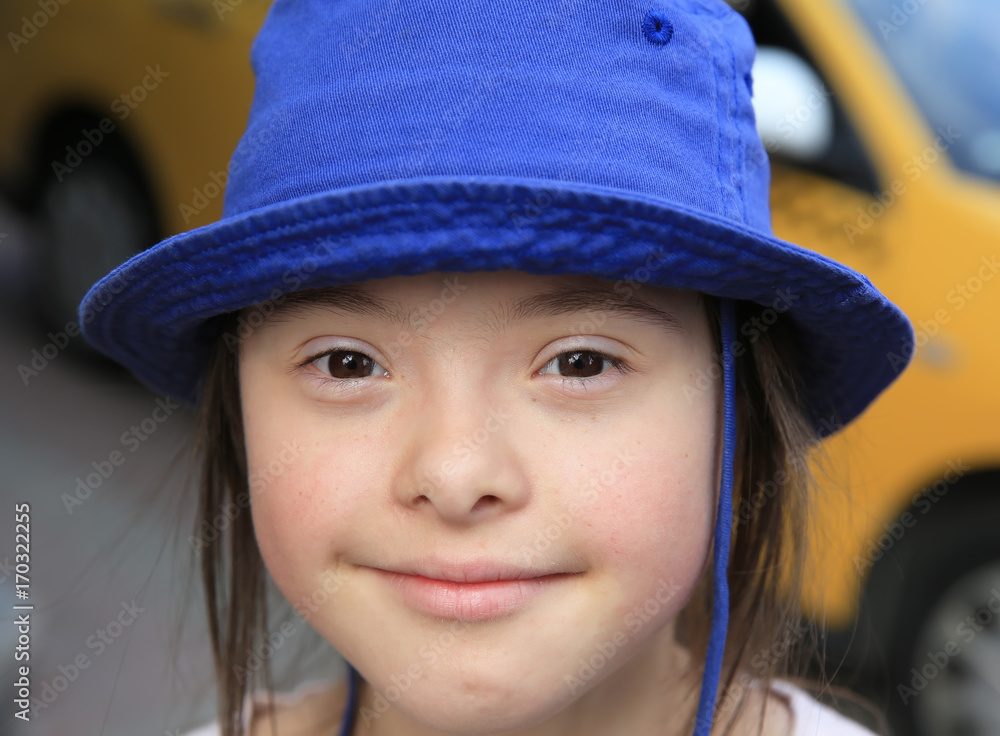 Cute smiling down syndrome girl on the background of taxi Cute smiling down syndrome girl on the background of taxi