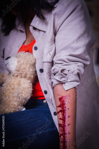 Close up of a young depressive woman with her arm bleeding, with a teddy bear in her legs, in a blurred background photo