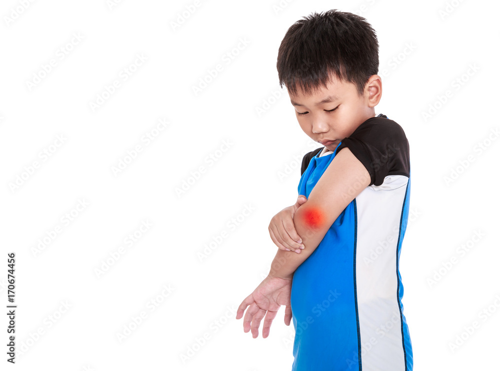 Asian child cyclist injured at elbow. Isolated on white background. Asian child cyclist injured at elbow. Isolated on white background.
