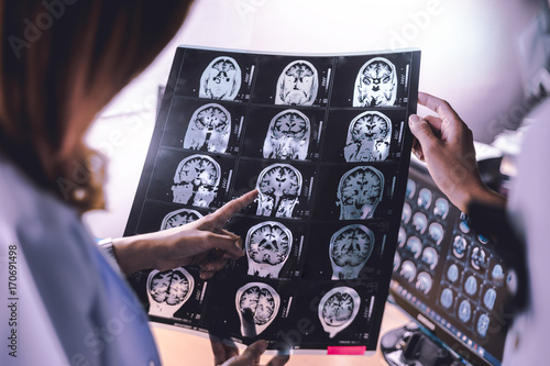 brain atrophy on MRI of Dementia patient