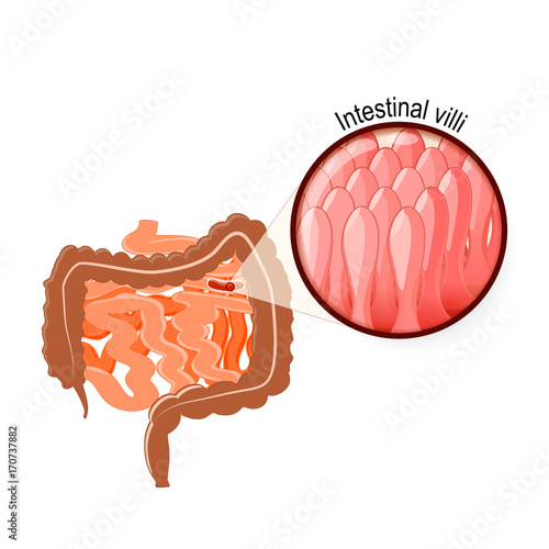 Intestinal Villi, Large and small intestine