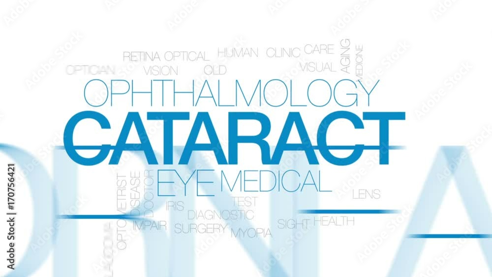 Cataract animated word cloud, text design animation. Kinetic typography. Cataract animated word cloud, text design animation. Kinetic typography.