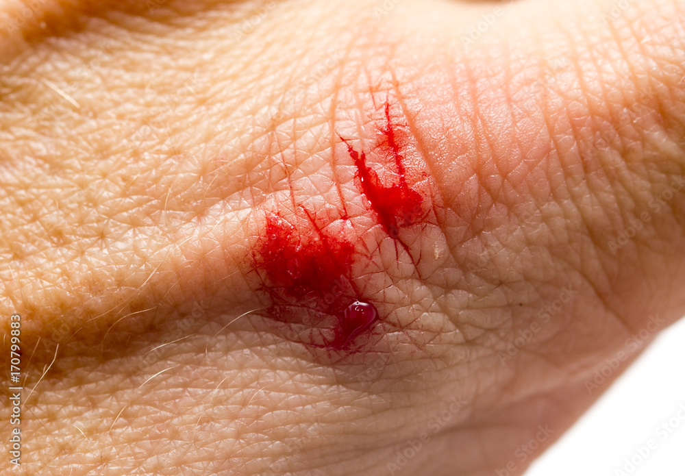 Fototapeta premium Blood on the skin from a cut with a knife