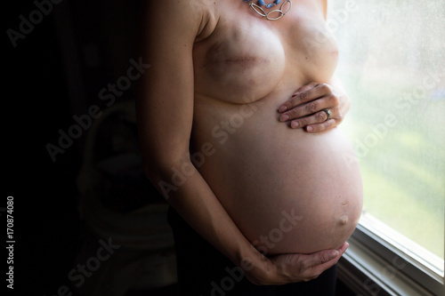 Pregnant breast cancer survivor with double mastectomy photo