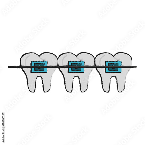Odontology dental braces icon vector illustration graphic design