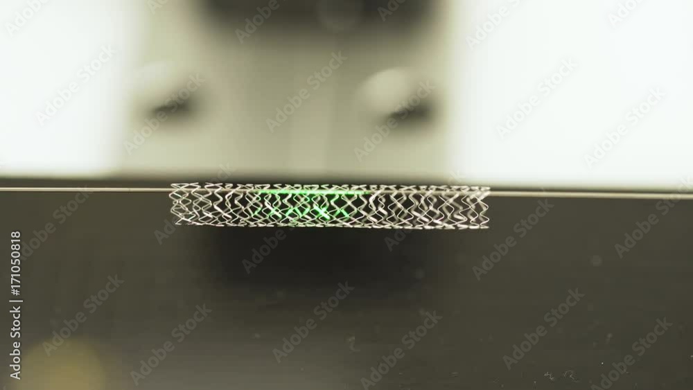 Video Stock Coronary stent is a small mesh tube that s used to treat