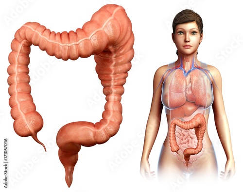 Woman with mega colon, illustration