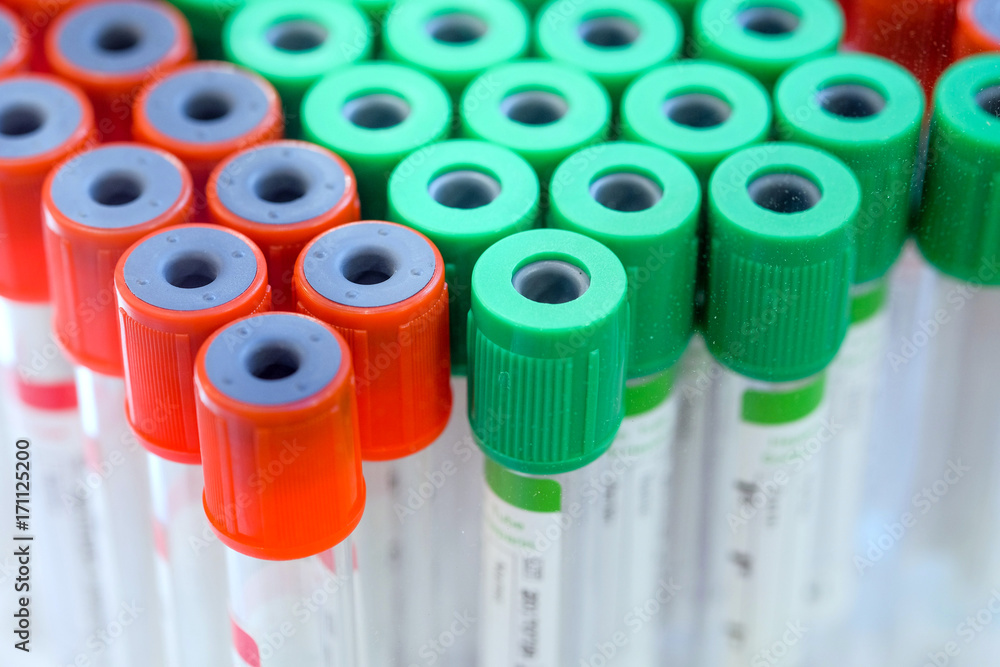 Group of medical sample tube, sample tube of blood for in the lab to diagnose the patient's disease, Green tube is prevent the hardening of blood, Red tube is helps accelerate the hardening of blood Group of medical sample tube, sample tube of blood for in the lab to diagnose the patient's disease, Green tube is prevent the hardening of blood, Red tube is helps accelerate the hardening of blood
