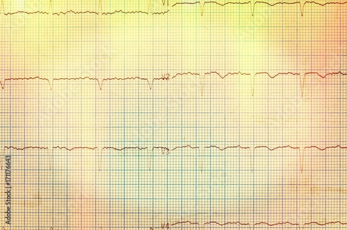 Heart analysis  electrocardiogram graph  ECG 