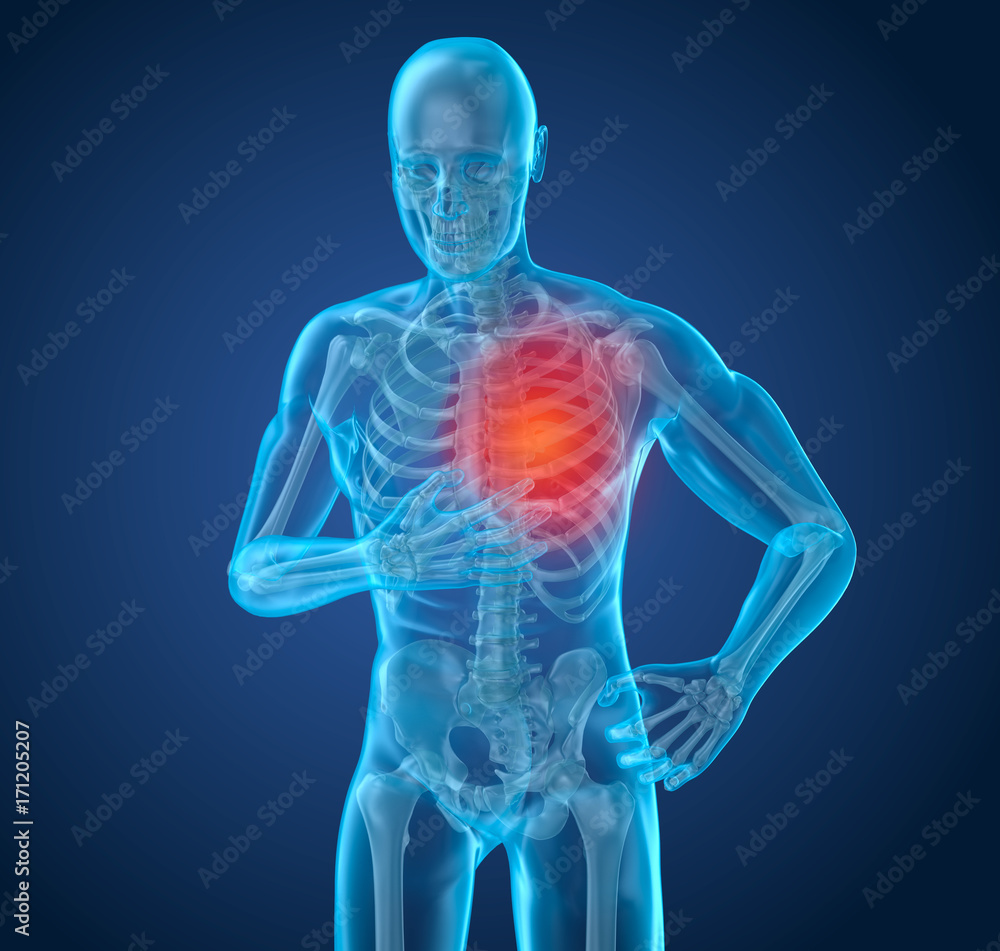 Heart Attack, man suffering from heart pain. 3D illustration Heart Attack, man suffering from heart pain. 3D illustration