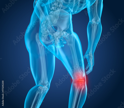 Knee pain Attack, man suffering from spinal knee. 3D illustration