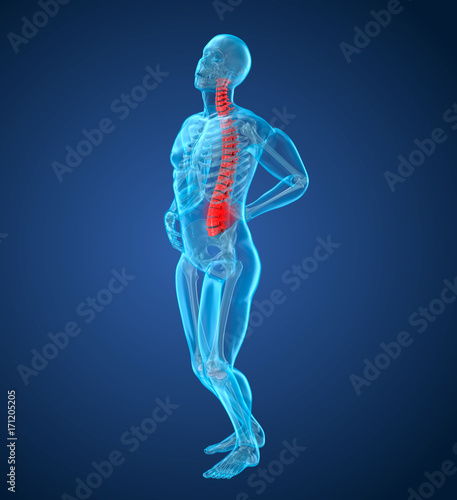 Spinal pain Attack, man suffering from spinal pain. 3D illustration © Alex Mit