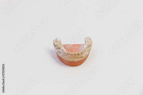Cast of teeth isolated on white background. Denture, close up