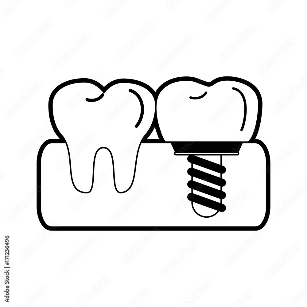 crown dentistry related icon image vector illustration design black and white crown dentistry related icon image vector illustration design black and white