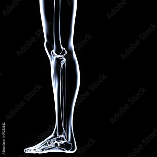 3D Illustration of Human Body Bone Joint Pains (Knee Joints) 