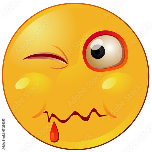 Inured yellow emoji vector image