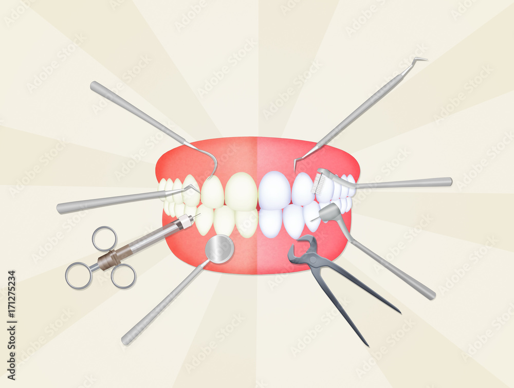 mouth with dentist tools mouth with dentist tools