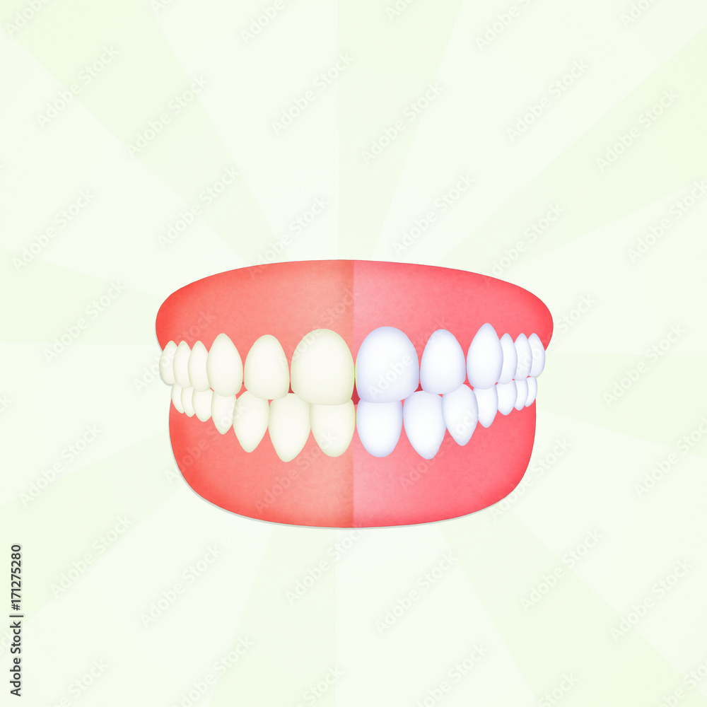 Obraz premium before and after cleaning the teeth