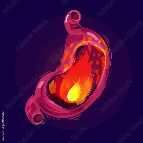 Fire in human stomach. sick stomach acid in the stomach - vector