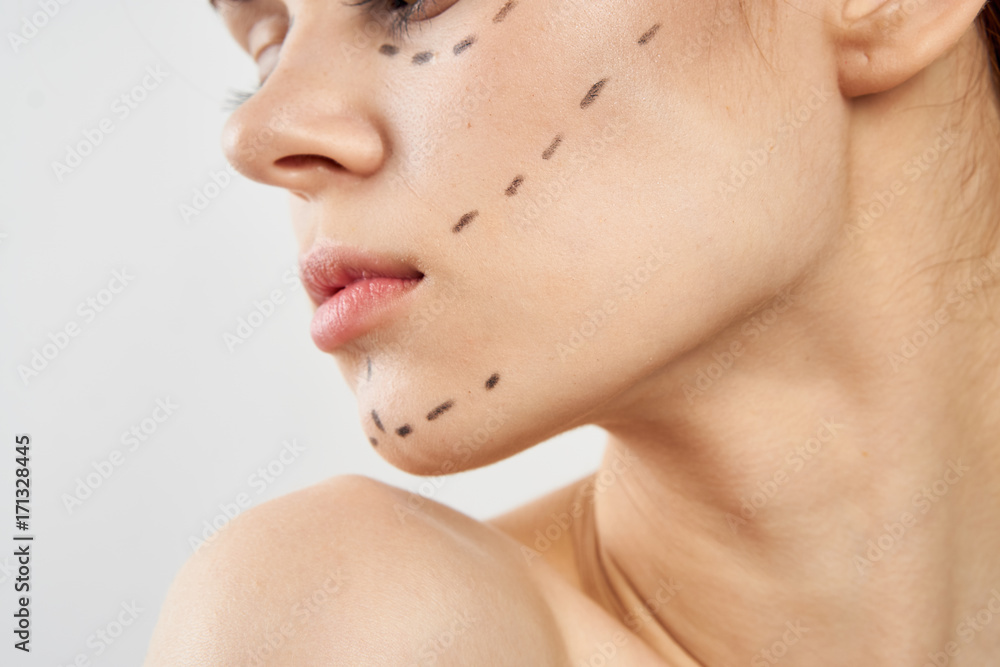 contour for plastic surgery, portrait, close-up