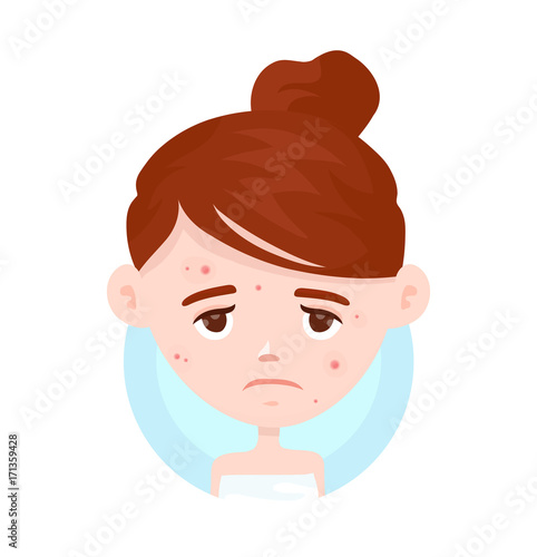Unhappy teen girl struggling acne