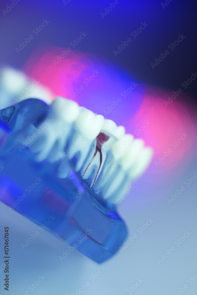 Dental teeth dental model Dental teeth dental model