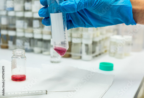 The scientist woman hands in gloves, do test in biochemistry lab photo