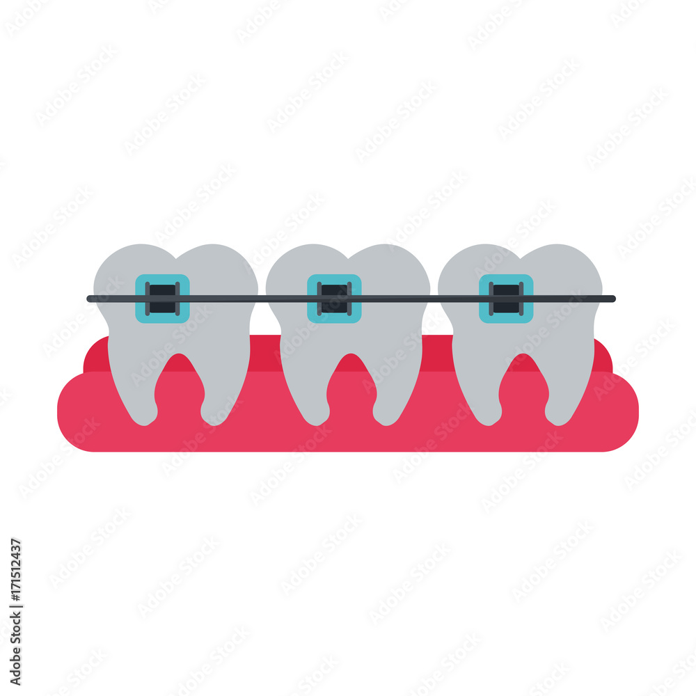 molar teeth with braces dentistry icon image vector illustration design molar teeth with braces dentistry icon image vector illustration design