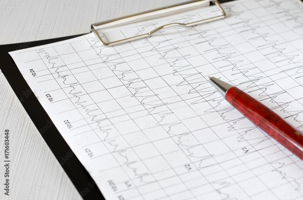 Electrocardiogram graph (ECG), heart analysis. Black clipboard Electrocardiogram graph (ECG), heart analysis. Black clipboard