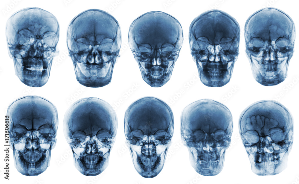 Collection of asian skull . front view . isolated background Collection of asian skull . front view . isolated background