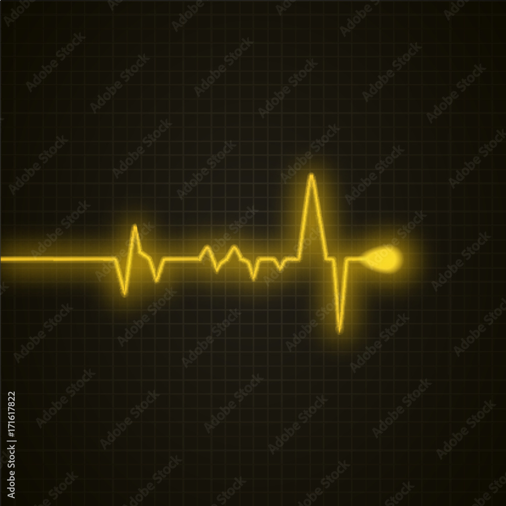 Medical background with heart cardiogram. Heart pulse isolated. Vector background.
