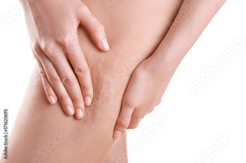 Woman with cellulite problem on white background