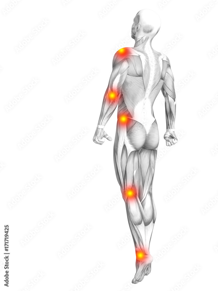 Conceptual human muscle anatomy with red and yellow hot spot inflammation or articular joint pain for health care therapy or sport concepts. 3D illustration man arthritis or bone osteoporosis disease Conceptual human muscle anatomy with red and yellow hot spot inflammation or articular joint pain for health care therapy or sport concepts. 3D illustration man arthritis or bone osteoporosis disease