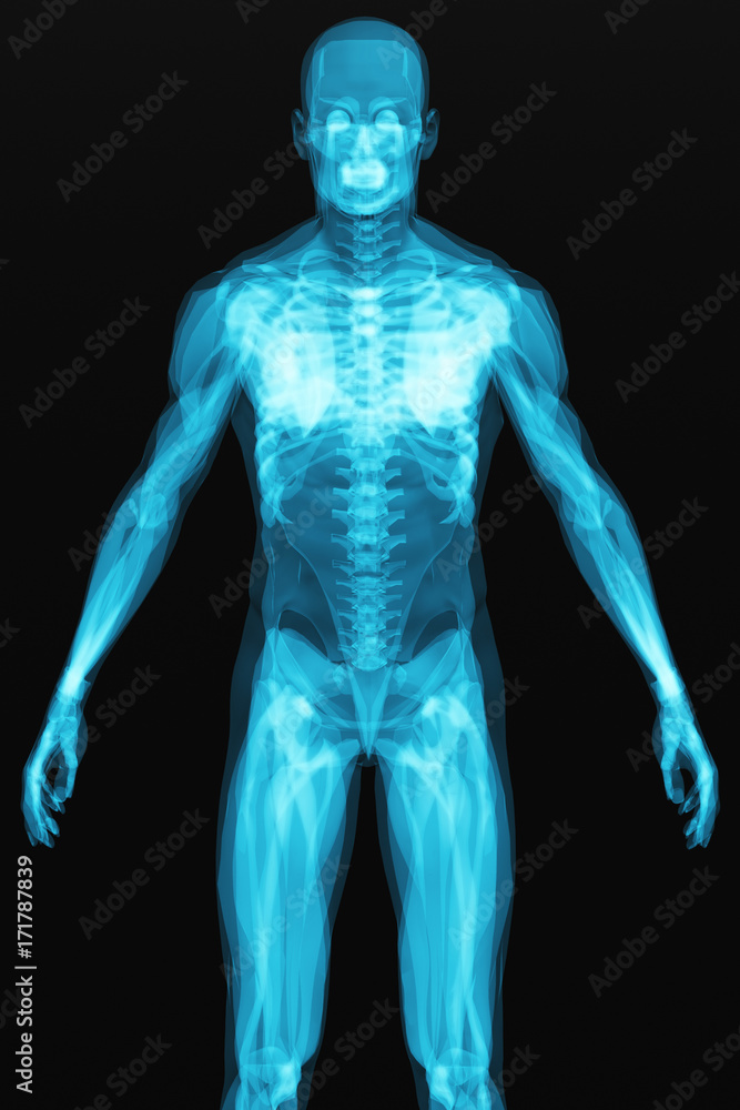 X-ray scan of the human body X-ray scan of the human body