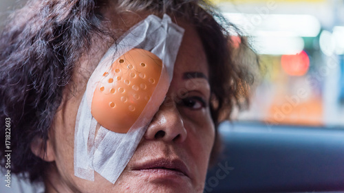 Patient asian women show her eyes with eye shield