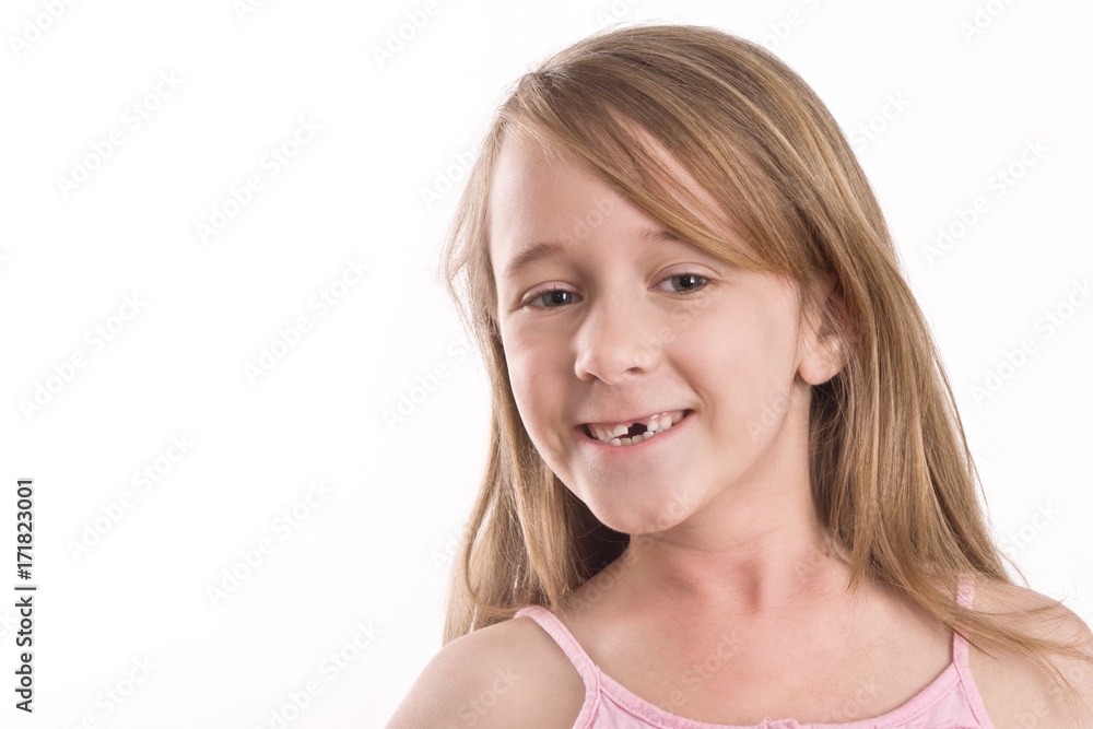 young girl showing off her missing front tooth young girl showing off her missing front tooth
