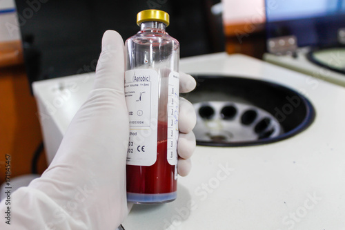 Hemoculture bottles