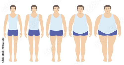 Body mass index vector illustration from underweight to extremely obese in flat style. Man with different obesity degrees. Male body with different weight.